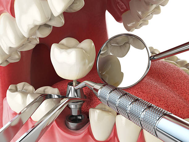 Best Emergency Gum Pain Relief  in Geneseo, IL